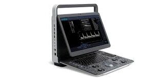SONOSCAPE E1EXP Portable Colour Doppler: Ultrasound Machine